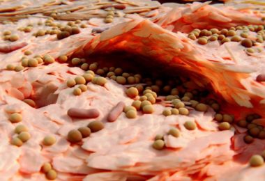Staphylococcus aureus: um versátil vilão